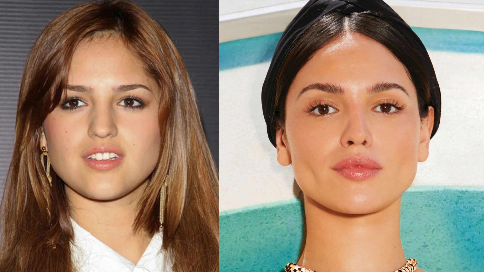 Eiza González before and after surgery