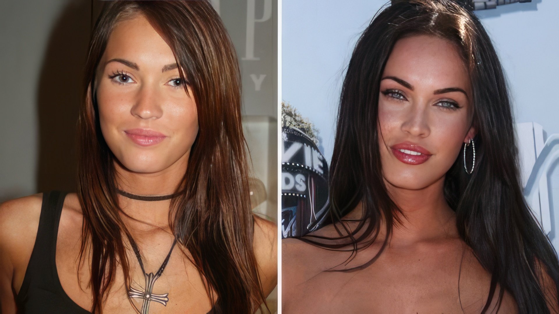 Megan Fox before and after the plastic surgery