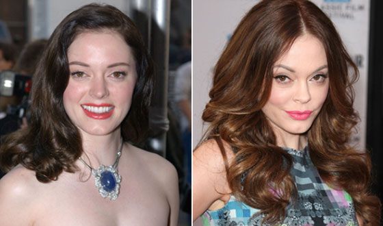 Rose McGowan before and after the accident