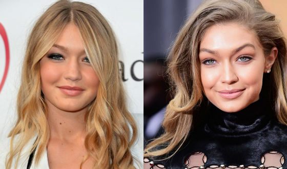 Gigi Hadid before and after plastic surgery (2012 VS 2016)