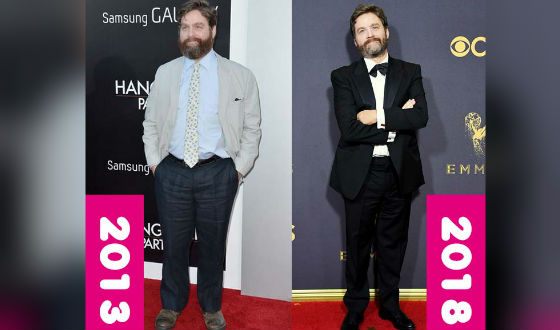 Zach Galifianakis Lost Weight and Now He Looks Like a Completely Different Person
