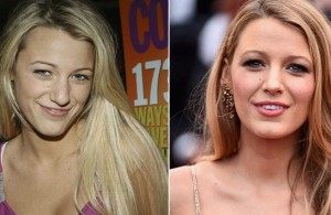 30 most beautiful women in the world before and after plastics