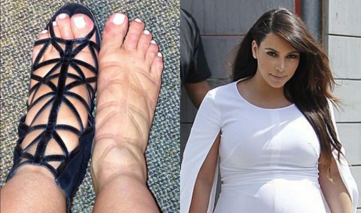 Kim Kardashian and her feet