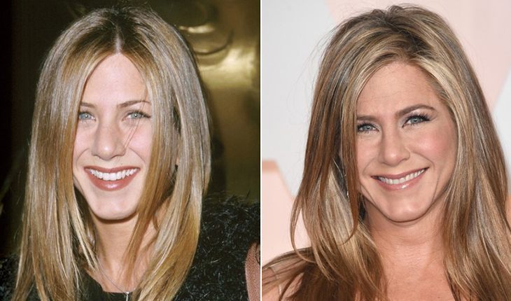 Jennifer Aniston before and after plastic surgery