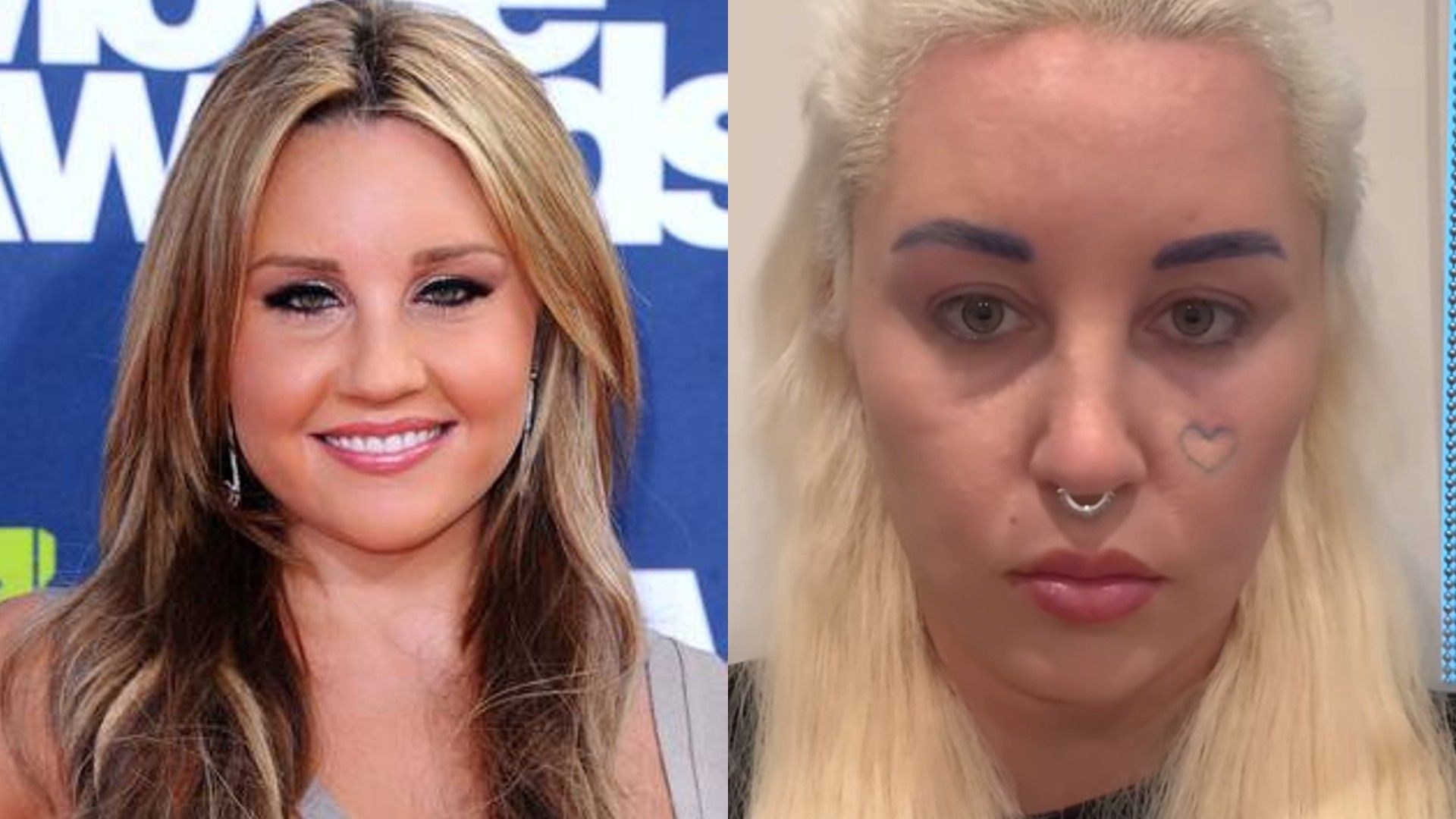 Amanda Bynes - before and after the surgery