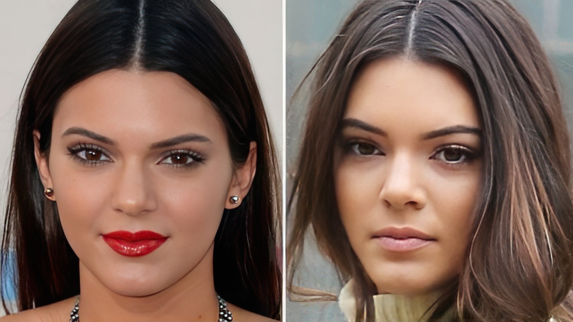 Kendall Jenner Had Rhinoplasty