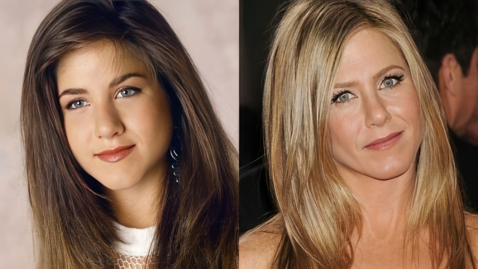 Jennifer Aniston before and after rhinoplasty