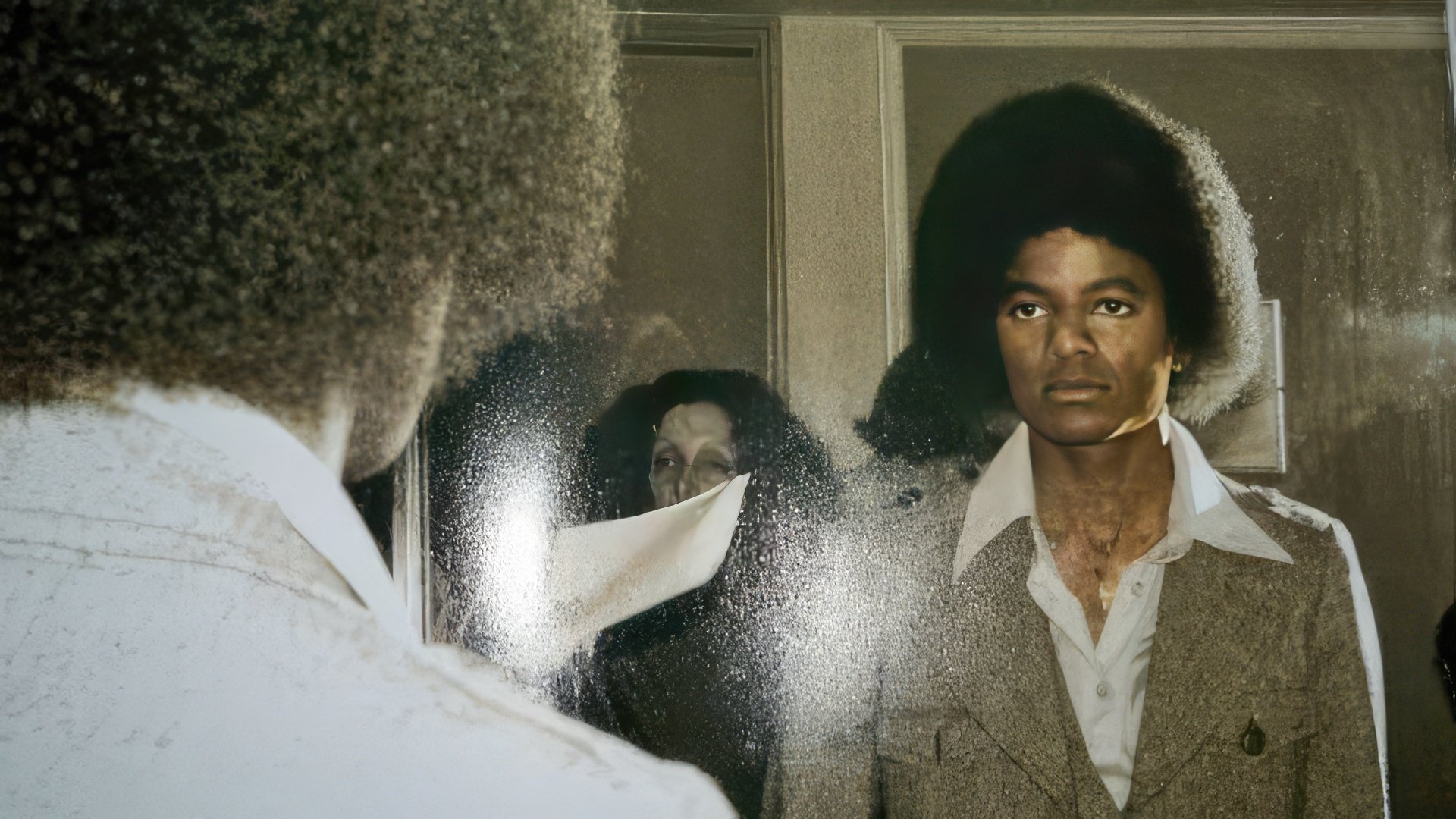 Vitiligo Manifested in Michael Jackson in His Youth