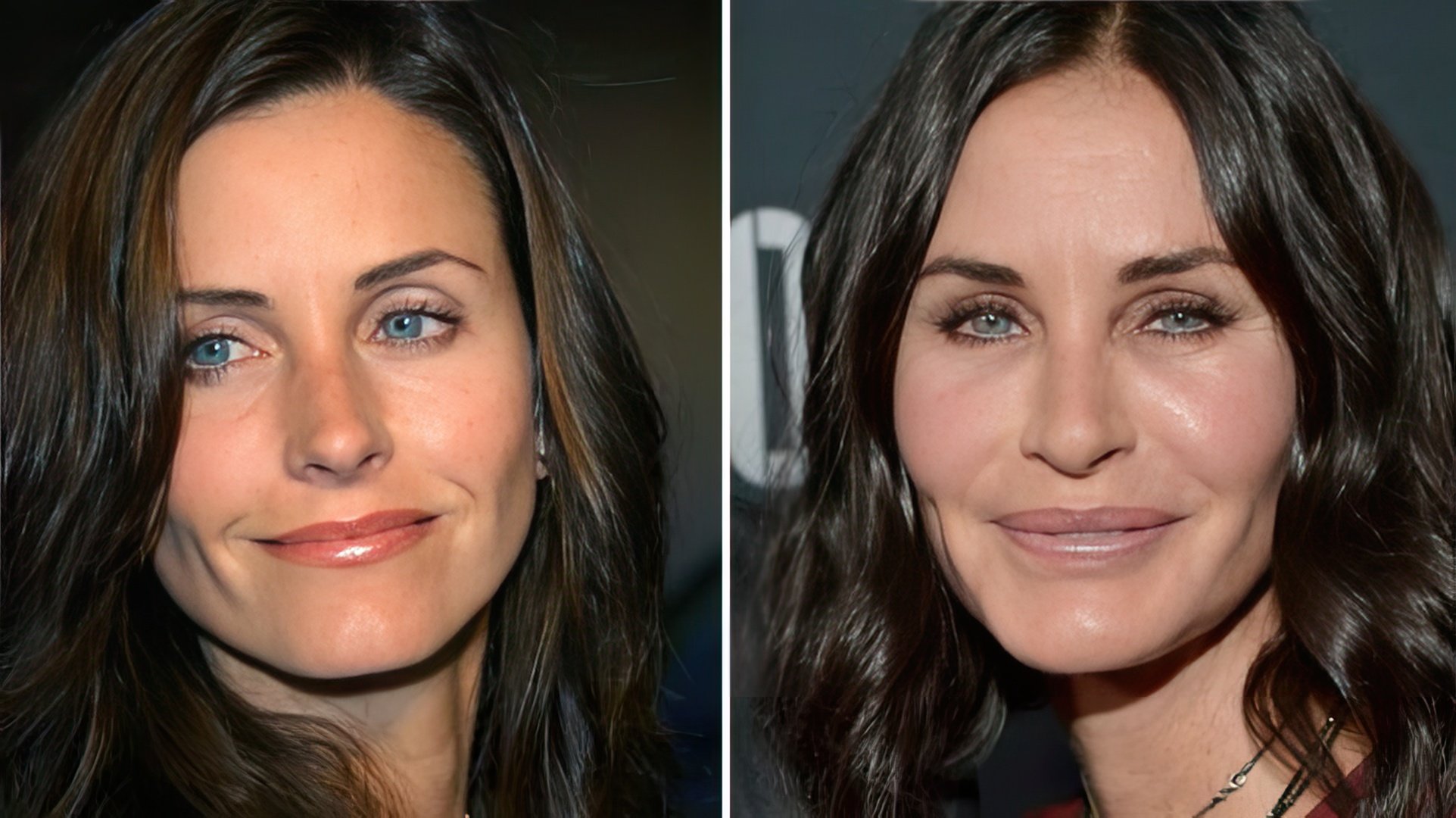 Courteney Cox before and after plastic surgery