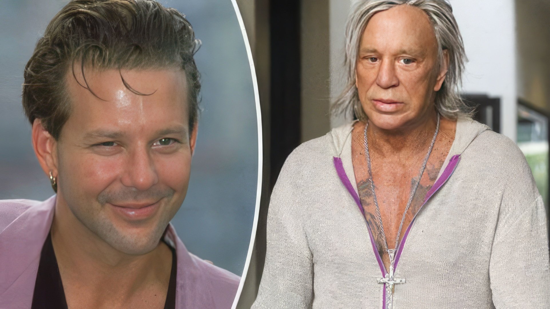 Mickey Rourke Before and After Plastic Surgery
