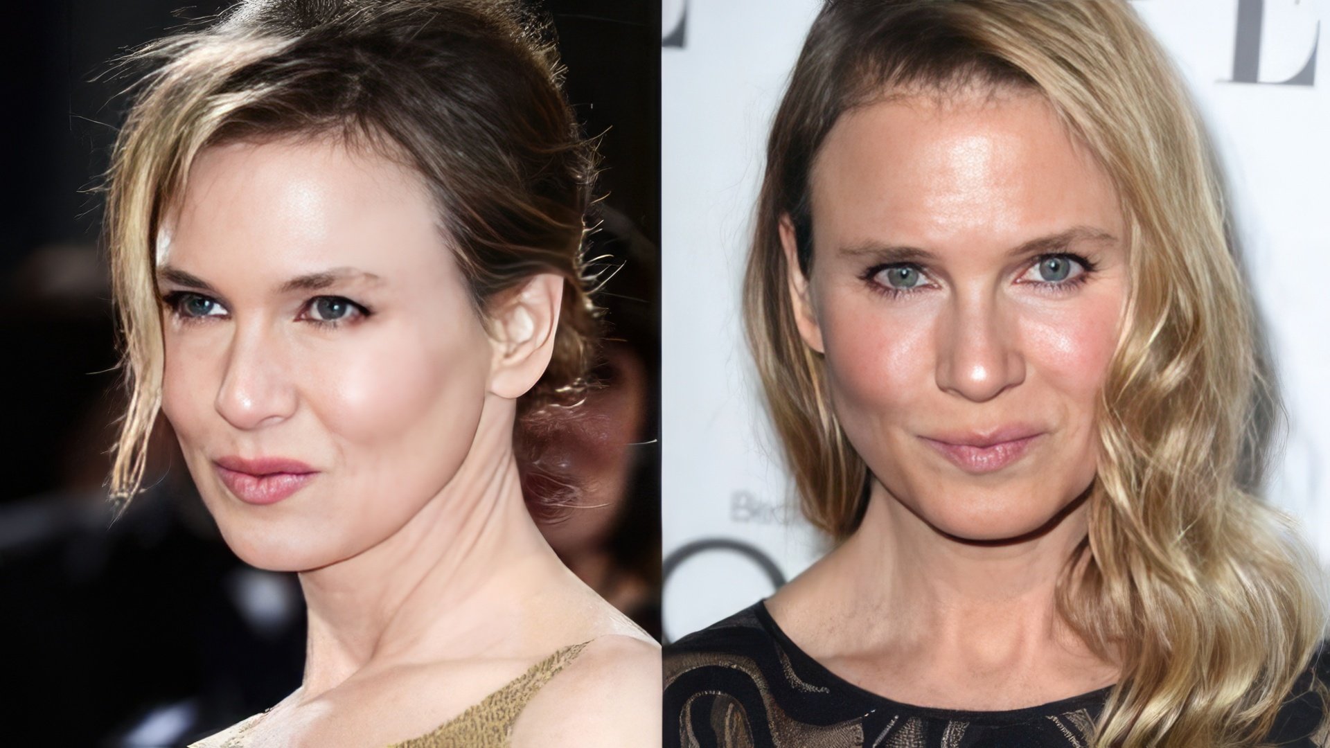 Renee Zellweger before and after surgery