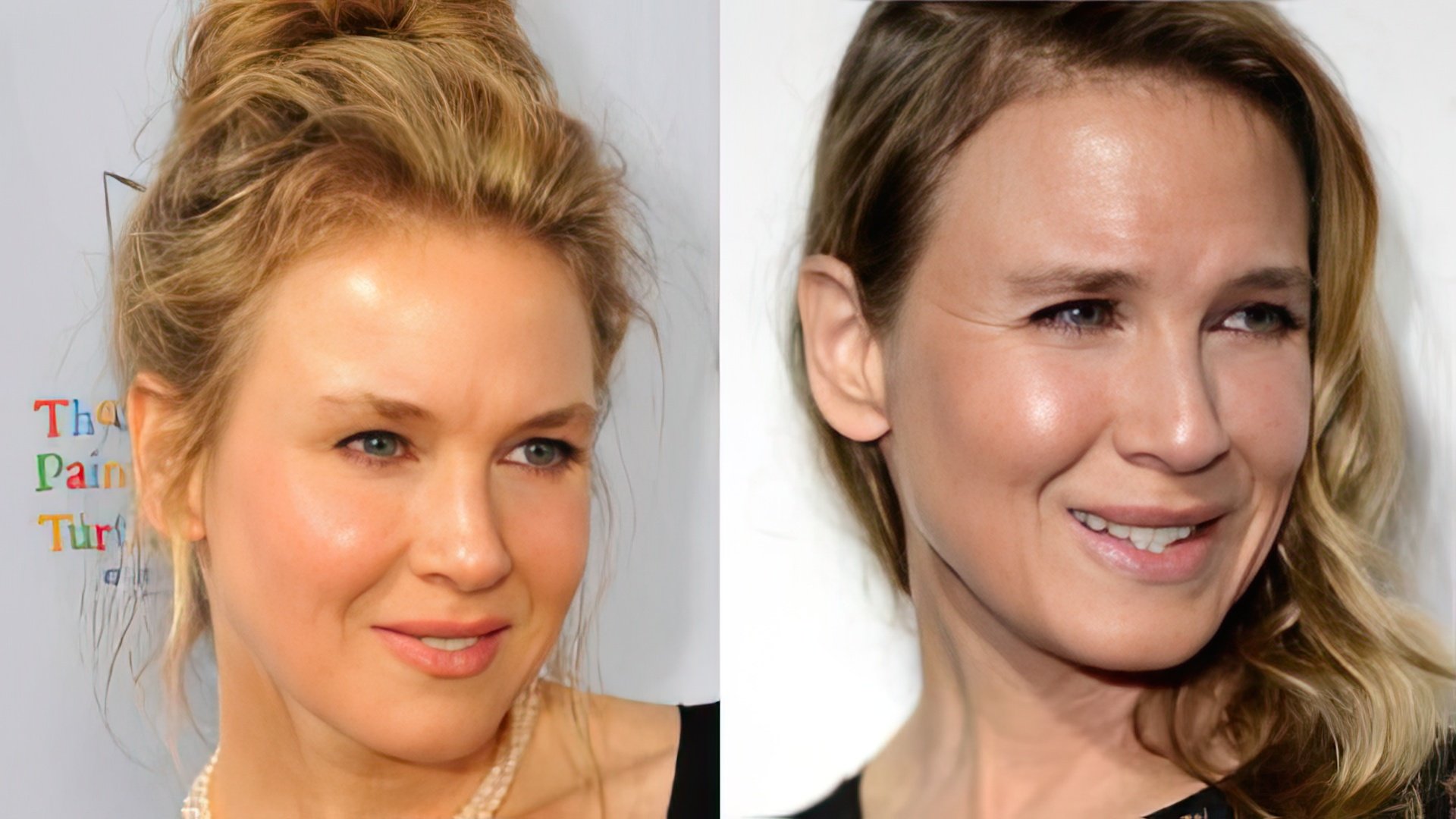 Many believe Renee Zellweger ruined her looks with surgery.