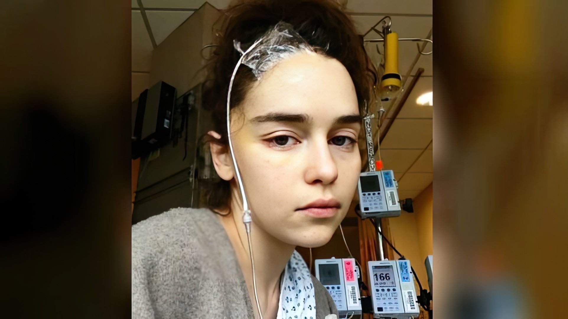 Due to an aneurysm, Emilia Clarke underwent three operations