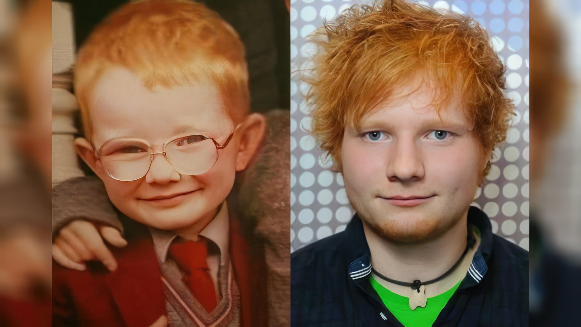 Ed Sheeran in Childhood and Now