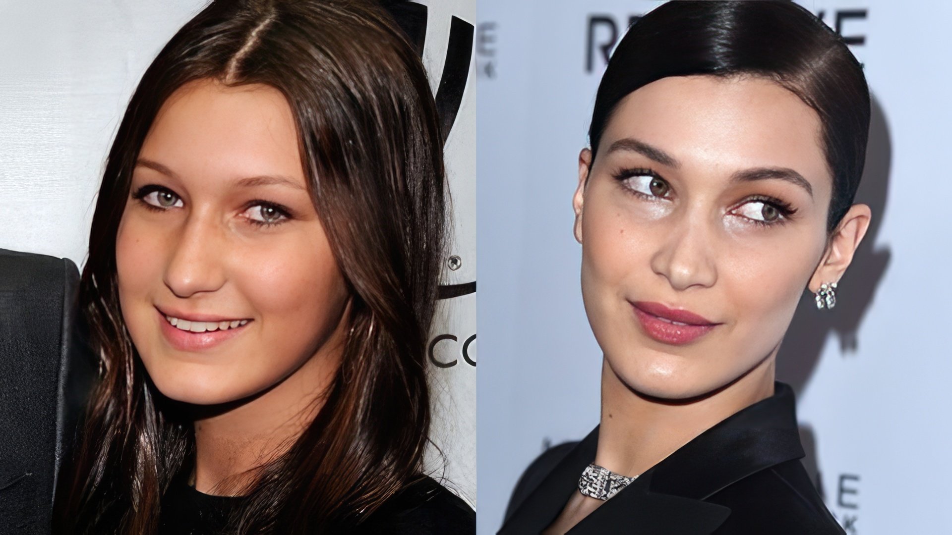 Bella Hadid before and after plastic surgery