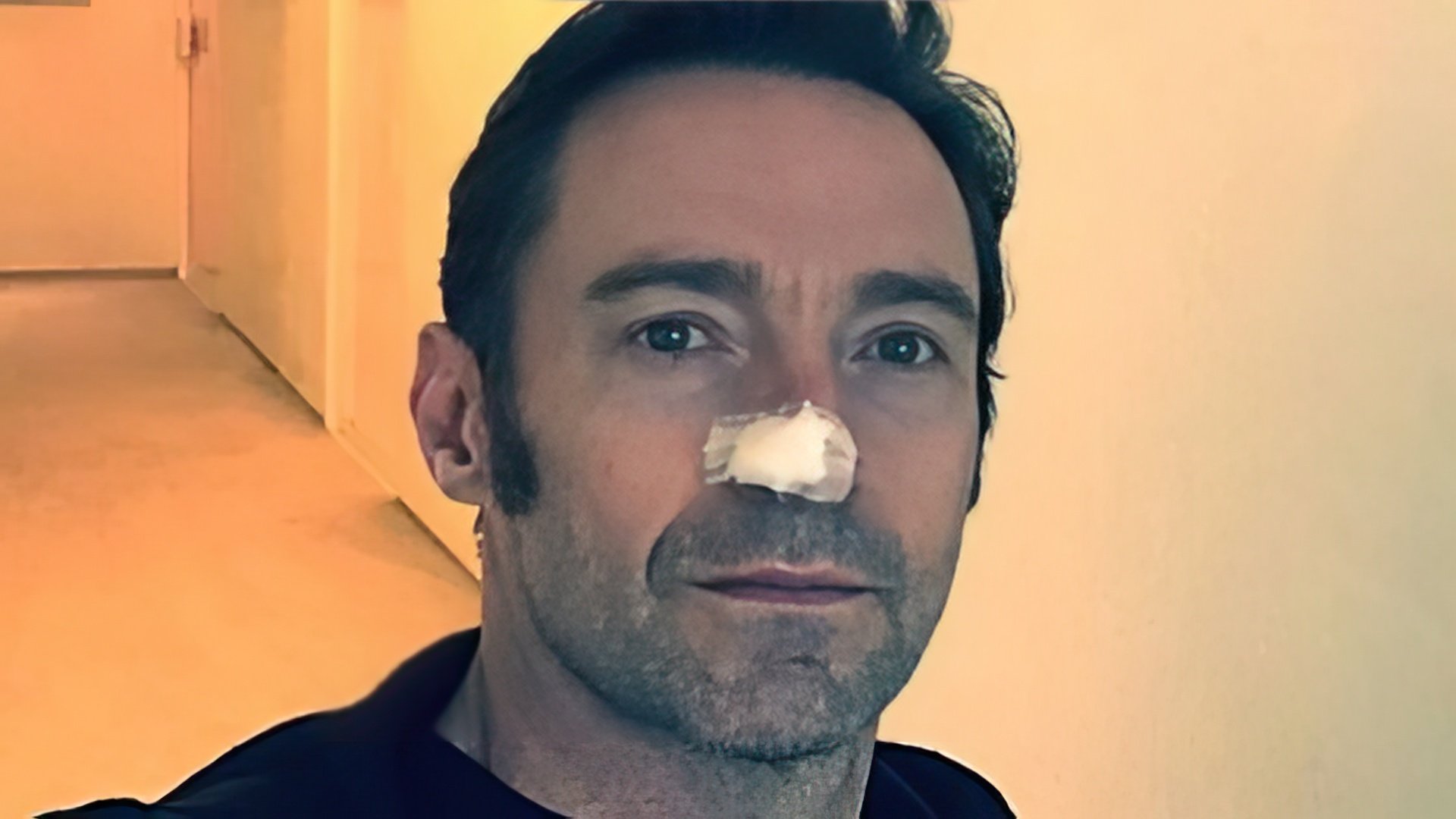 Hugh Jackman has been fighting skin cancer