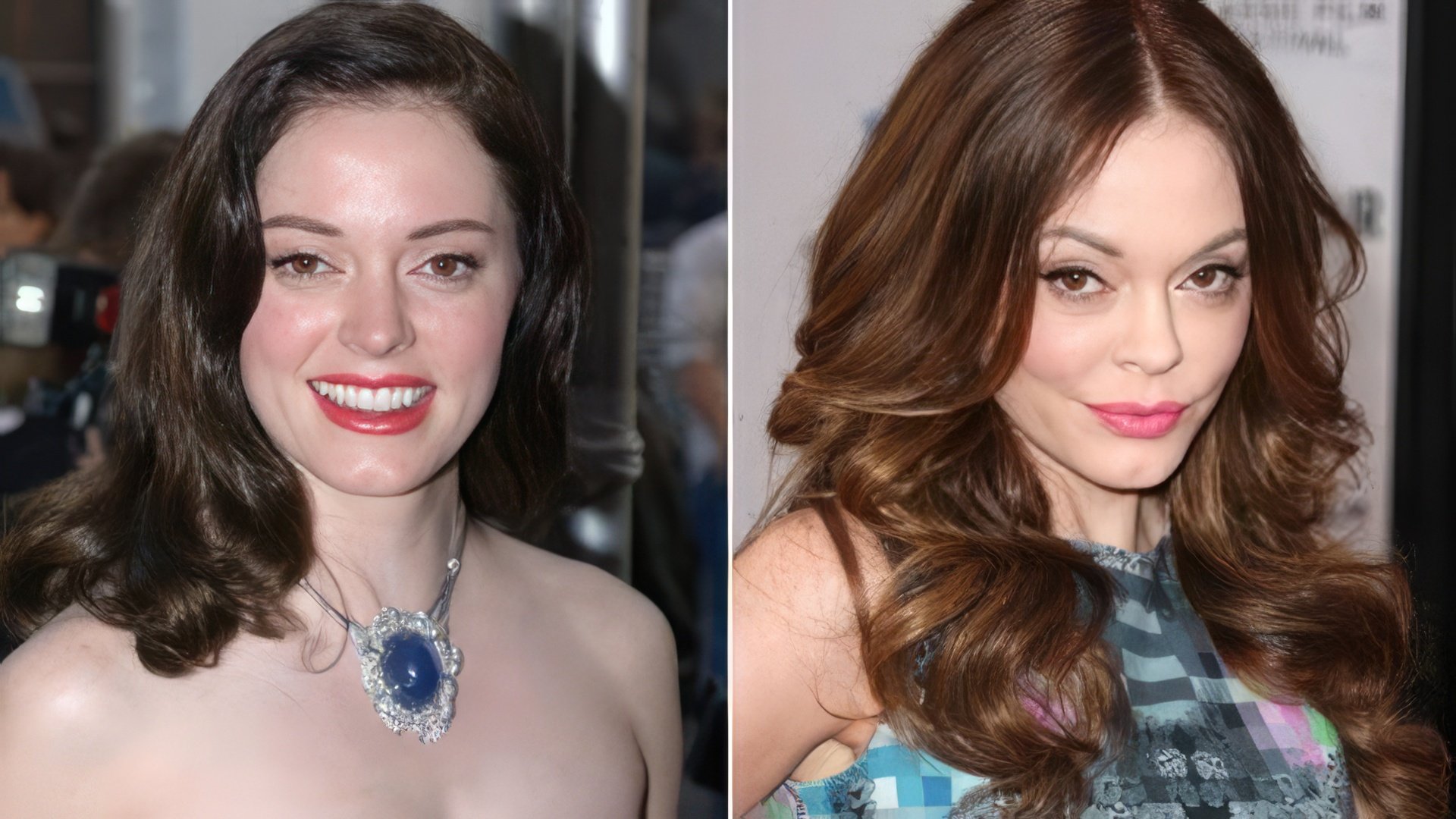 Rose McGowan before and after the accident