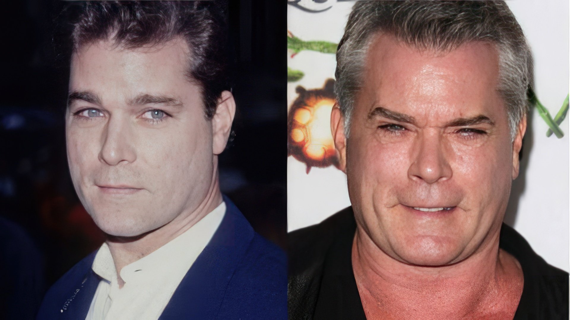 Ray Liotta before and after plastic surgery