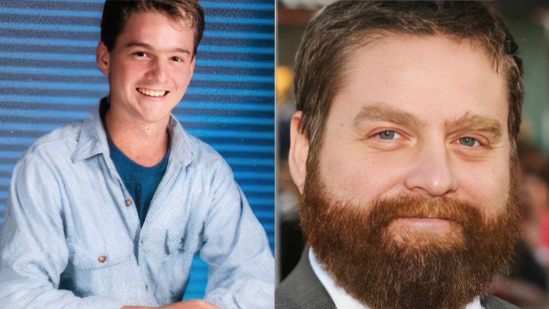 Zach Galifianakis Now and Then