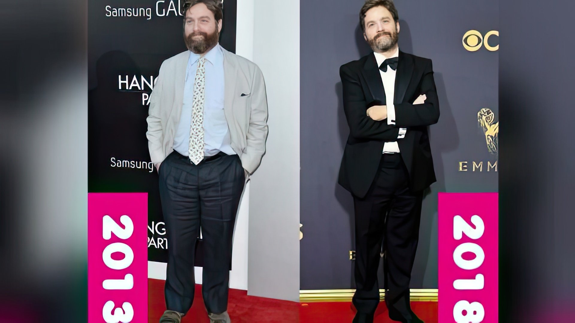 Zach Galifianakis Lost Weight and Now He Looks Like a Completely Different Person