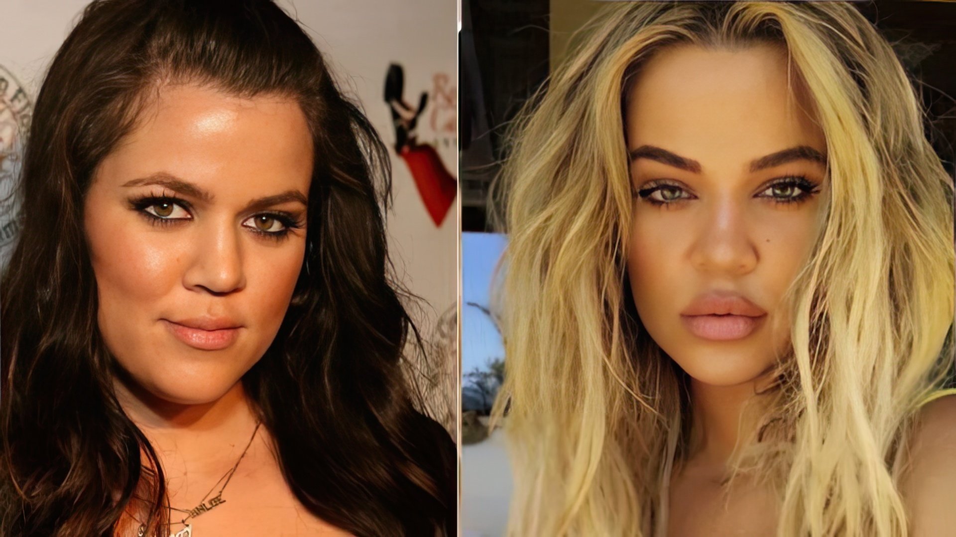 Khloé Kardashian: before and after the plastic surgery