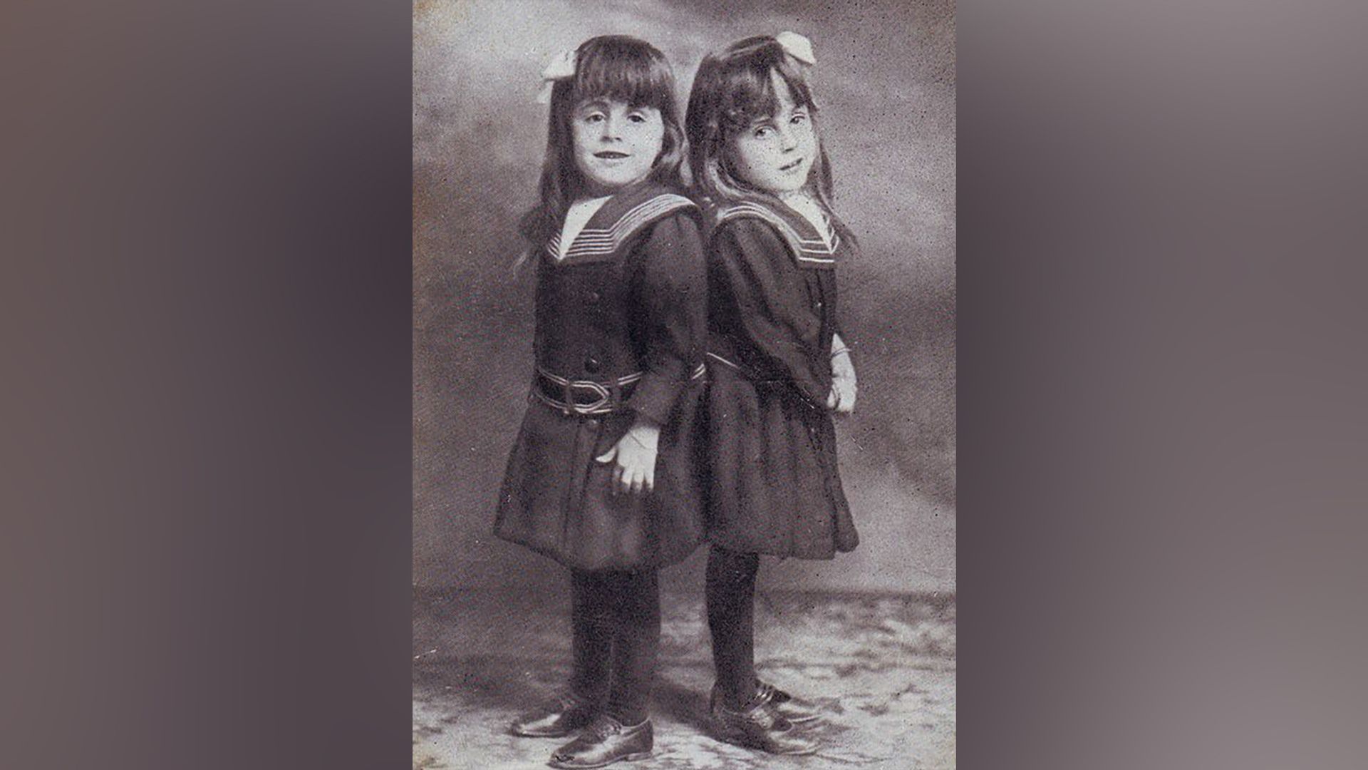 Daisy and Violet Hilton as children