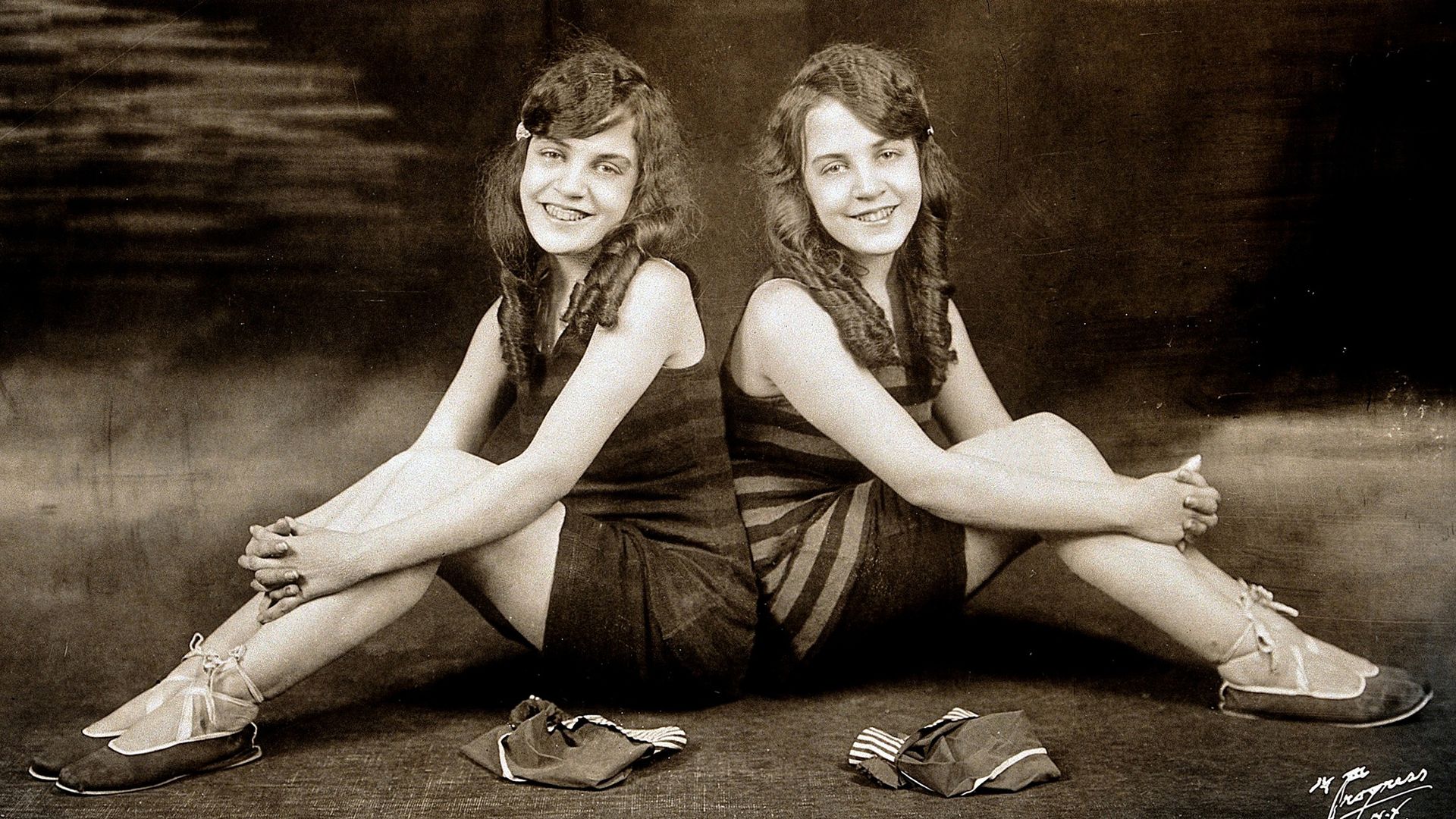 Siamese twins Daisy and Violet Hilton