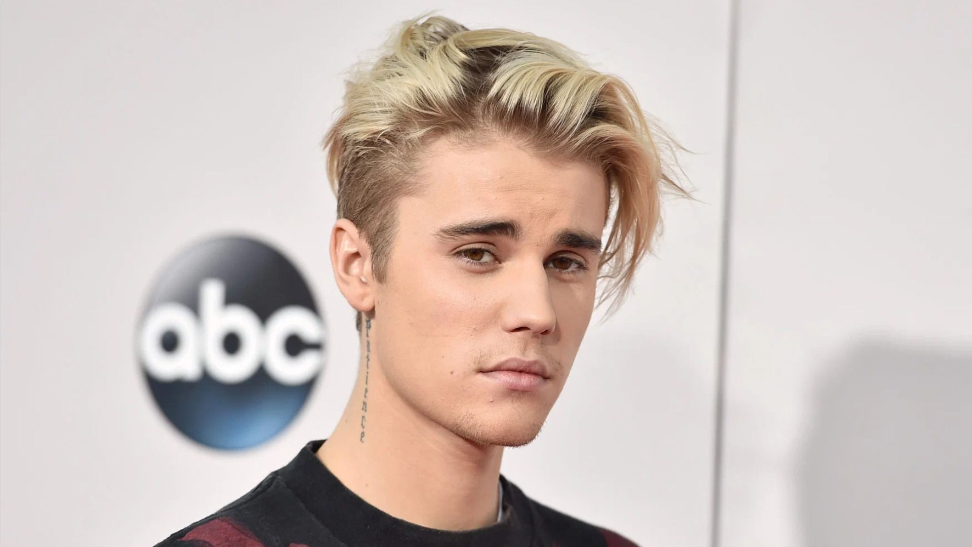 Fans are concerned about Justin Bieber`s health due to new photos