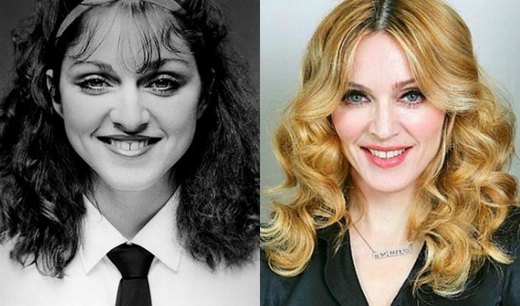 Madonna before and after plastic surgery