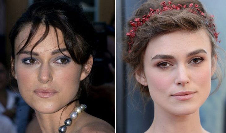 Keira Knightley before and after plastic surgery