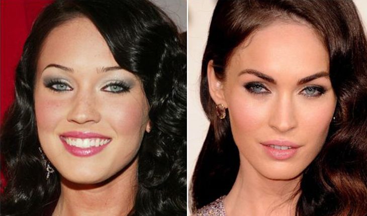 Megan Fox before and after a series of plastic surgery
