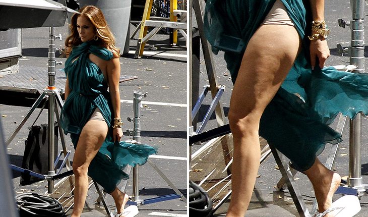 Ugly legs of Jennifer Lopez