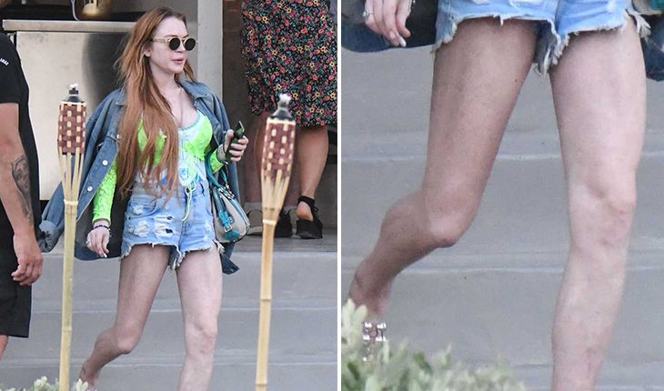 Lindsay Lohan`s scary legs