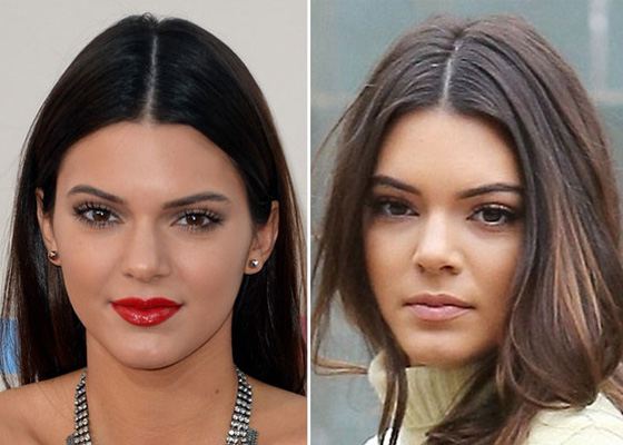 It's Surmised that Kendall Jenner had Rhinoplasty