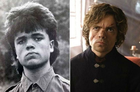 Peter Dinklage in his childhood and now